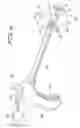 Fig. 05 - SURGICAL RETRACTOR