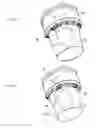 Fig. 16 - Tissue handling system with reduced operator exposure