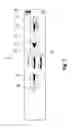 Fig. 06 - Biopsy device having a vacuum pump