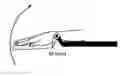 Fig. 01 - Quantification of mechanical and neural contributions to spasticity