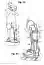 Fig. 07 - Orthotic Assembly for Selectively off-Loading a Weight-Bearing Joint