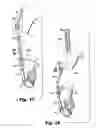 Fig. 10 - Orthotic Assembly for Selectively off-Loading a Weight-Bearing Joint