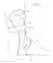 Fig. 04 - Ankle joint orthosis