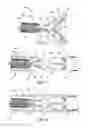 Fig. 04 - Endoscopic sheet delivery