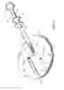 Fig. 05 - Endoscopic sheet delivery