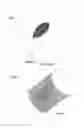 Fig. 04 - WOUND COMPRESS AND METHODS