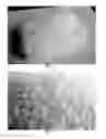 Fig. 05 - WOUND COMPRESS AND METHODS