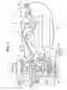 Fig. 02 - Method and apparatus for supplying predetermined gas into body cavities of a patient