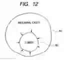 Fig. 10 - Method and apparatus for supplying predetermined gas into body cavities of a patient