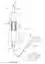 Fig. 03 - System and methods for endovascular aneurysm treatment