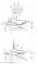 Fig. 05 - System and methods for endovascular aneurysm treatment