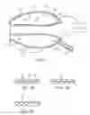 Fig. 06 - System and methods for endovascular aneurysm treatment