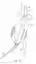 Fig. 08 - System and methods for endovascular aneurysm treatment