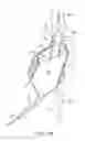 Fig. 09 - System and methods for endovascular aneurysm treatment