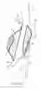Fig. 10 - System and methods for endovascular aneurysm treatment