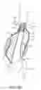 Fig. 11 - System and methods for endovascular aneurysm treatment