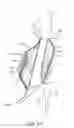 Fig. 19 - System and methods for endovascular aneurysm treatment