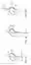 Fig. 20 - System and methods for endovascular aneurysm treatment