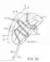 Fig. 22 - System and methods for endovascular aneurysm treatment