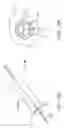 Fig. 27 - System and methods for endovascular aneurysm treatment