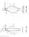 Fig. 28 - System and methods for endovascular aneurysm treatment