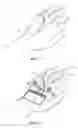 Fig. 04 - Transparent catheter securement system
