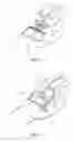Fig. 05 - Transparent catheter securement system
