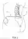 Fig. 03 - DRUG ACCEPTABILITY INDICATOR