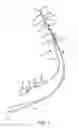 Fig. 02 - Partial-length indwelling urinary catheter permitting selective urine discharge