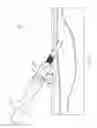 Fig. 04 - Surgical methods, devices, and kits