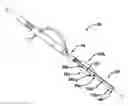 Fig. 01 - Methods and devices for applying multiple suture anchors