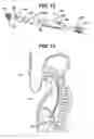 Fig. 09 - Methods and devices for applying multiple suture anchors