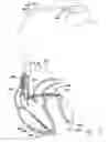 Fig. 11 - Systems and methods for exploiting the tip or ring conductor of an implantable medical device lead during an MRI to reduce lead heating and the risks of MRI-induced stimulation