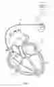 Fig. 02 - SYSTEMS AND METHODS TO DETECT IMPLANTABLE MEDICAL DEVICE CONFIGUARATION CHANGES AFFECTING MRI CONDITIONAL SAFETY