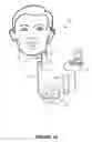 Fig. 02 - Dynamic cranial nerve stimulation based on brain state determination from cardiac data