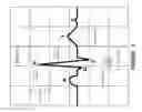 Fig. 05 - Dynamic cranial nerve stimulation based on brain state determination from cardiac data