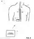 Fig. 03 - Adaptable current regulator for delivery of current-based electrical stimulation therapy
