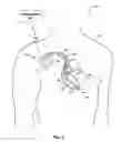 Fig. 03 - Timing coordination of implantable medical sensor modules