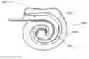 Fig. 01 - Hearing prosthesis electrode array with resiliently flexible tip member
