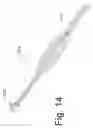 Fig. 15 - Bone fixation and fusion device