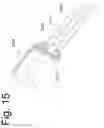 Fig. 16 - Bone fixation and fusion device