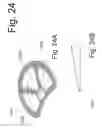 Fig. 25 - Bone fixation and fusion device