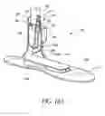 Fig. 19 - Foot prosthesis having cushioned ankle