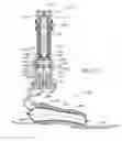 Fig. 27 - Foot prosthesis having cushioned ankle