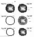 Fig. 60 - Regions of interest processing