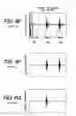 Fig. 09 - Ultrasonic flaw detector and ultrasonic flaw detection method