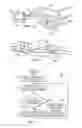 Fig. 14 - Method and apparatus for digitally evaluating insertion quality of customized orthodontic arch wire