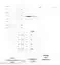 Fig. 01 - Processor exploiting trivial arithmetic operations