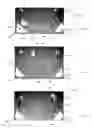 Fig. 08 - Infant support structure with a collapsible frame