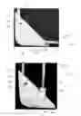 Fig. 13 - Infant support structure with a collapsible frame